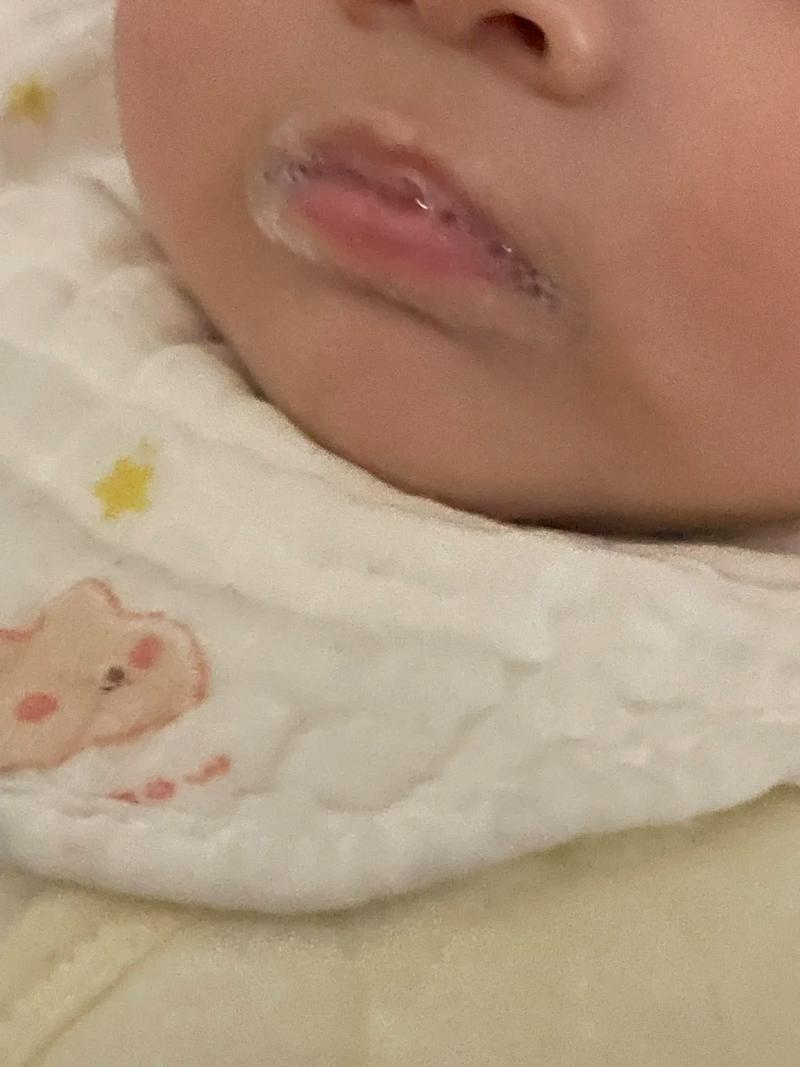 新生儿吐唾沫吐舌头是正常现象还是生病信号？家长该如何应对？-第1张图片-郑州医学网