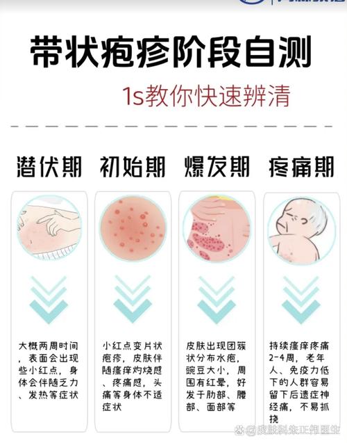 新生儿接种牛痘疫苗的最佳时间是什么时候?需要注意哪些事项?-第2张图片-郑州医学网 新生儿接种牛痘疫苗的最佳时间是什么时候?需要注意哪些事项?-第2张图片-郑州医学网