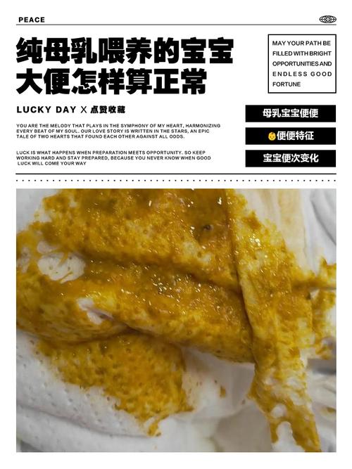 新生儿母乳便便图，不同阶段性状差异大，怎样算正常需警惕哪些异常？-第1张图片-郑州医学网