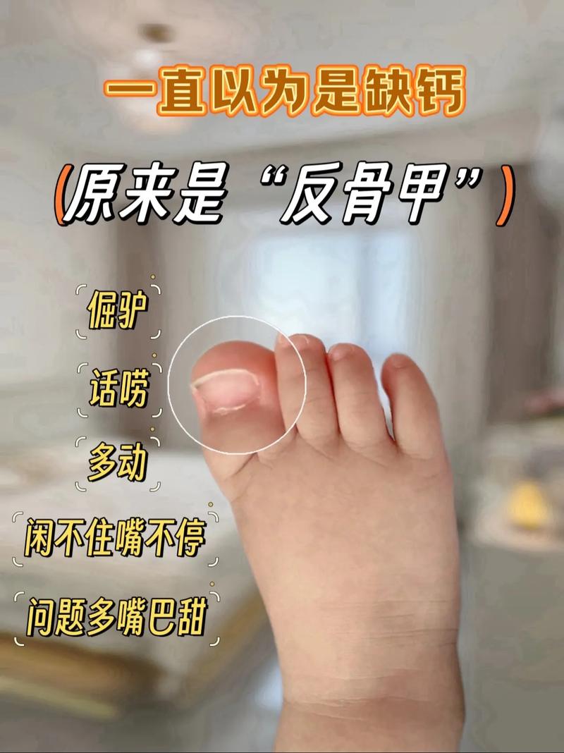 新生儿脚趾甲上翘是正常生理现象还是疾病信号？需警惕哪些潜在健康问题？-第1张图片-郑州医学网