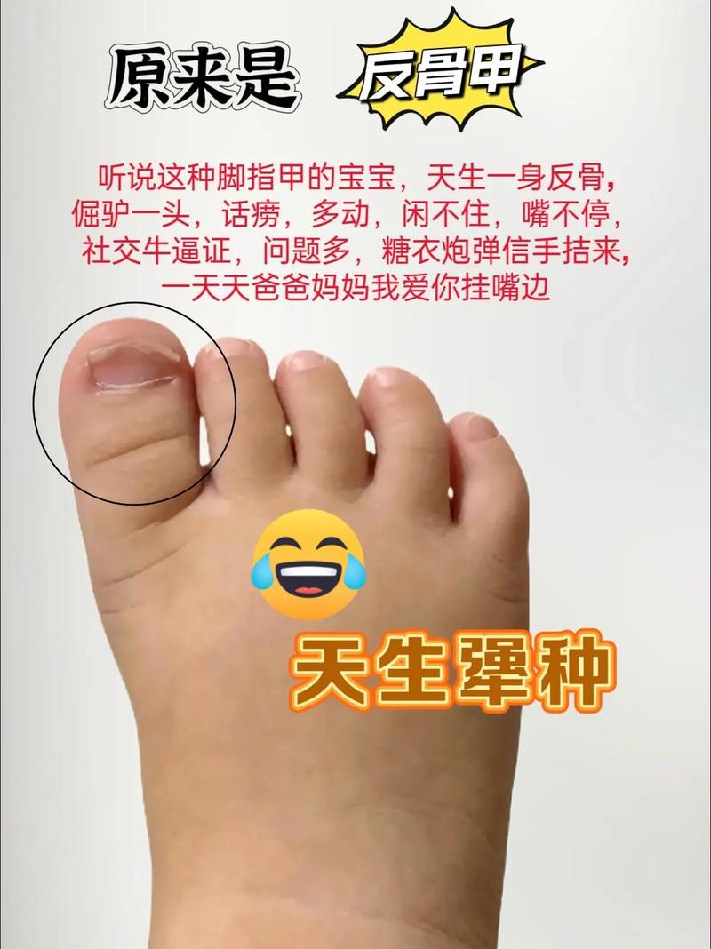 新生儿脚趾甲上翘是正常生理现象还是疾病信号？需警惕哪些潜在健康问题？-第2张图片-郑州医学网