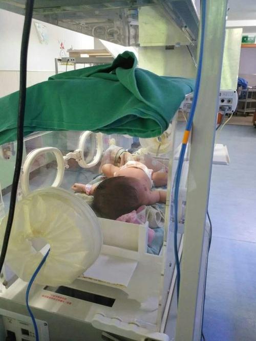 新生儿感染巨细胞病毒后会有哪些典型症状？家长该如何早期识别和应对？-第3张图片-郑州医学网