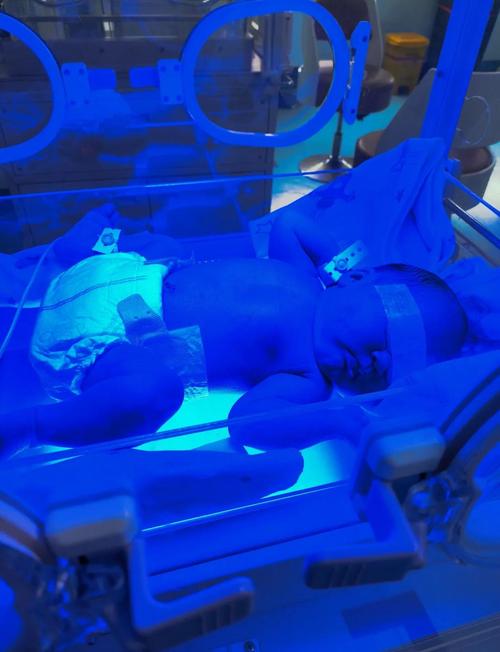 新生儿黄疸照蓝光八天还没退，到底正常吗？需要继续照还是该换方案？-第1张图片-郑州医学网