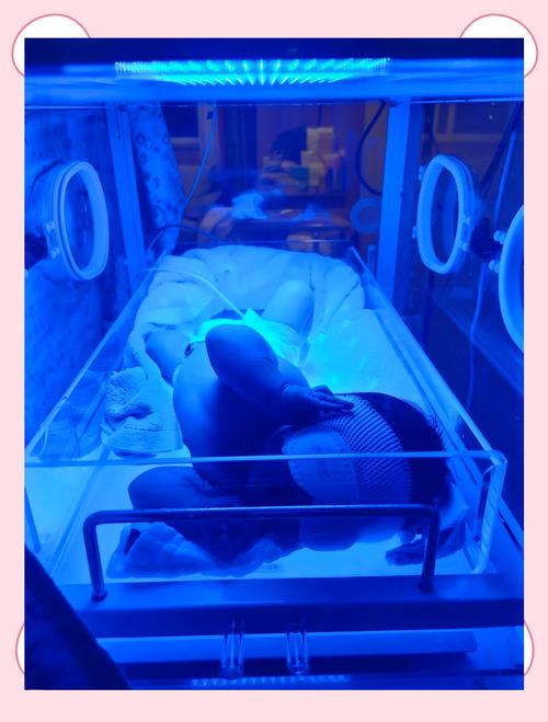 新生儿黄疸照蓝光八天还没退，到底正常吗？需要继续照还是该换方案？-第2张图片-郑州医学网