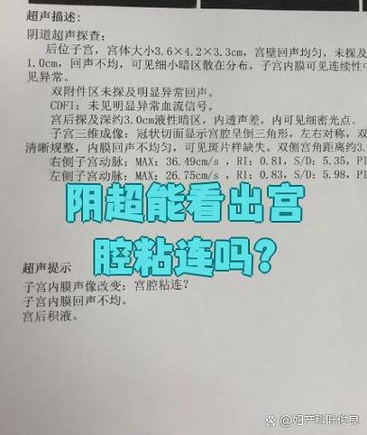孕期检查必须做阴超吗？有没有必要和风险？-第1张图片-郑州医学网
