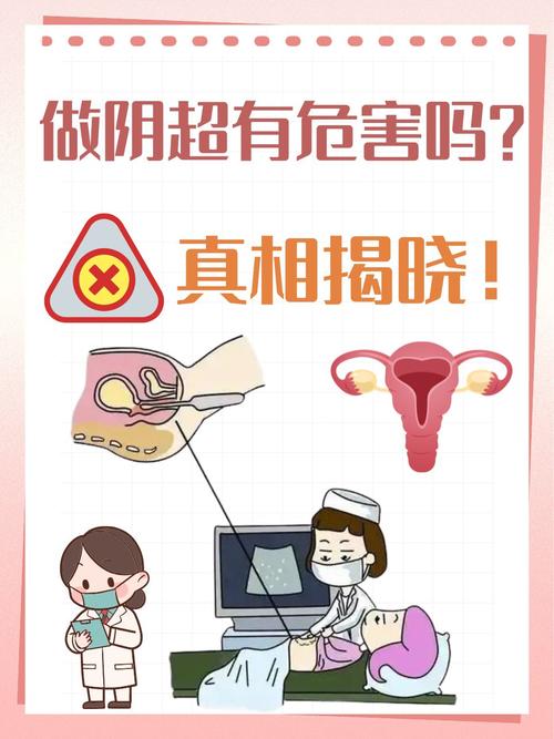 孕期检查必须做阴超吗？有没有必要和风险？-第2张图片-郑州医学网