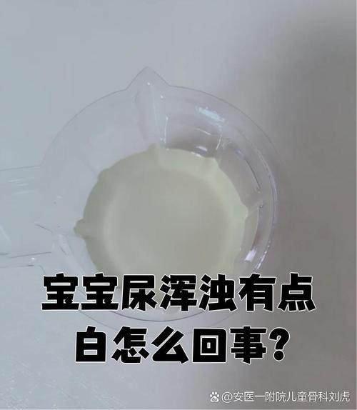 儿童尿液出现白色沉淀物是正常现象还是健康警报？需警惕哪些潜在问题？-第1张图片-郑州医学网