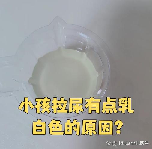 儿童尿液出现白色沉淀物是正常现象还是健康警报？需警惕哪些潜在问题？-第2张图片-郑州医学网