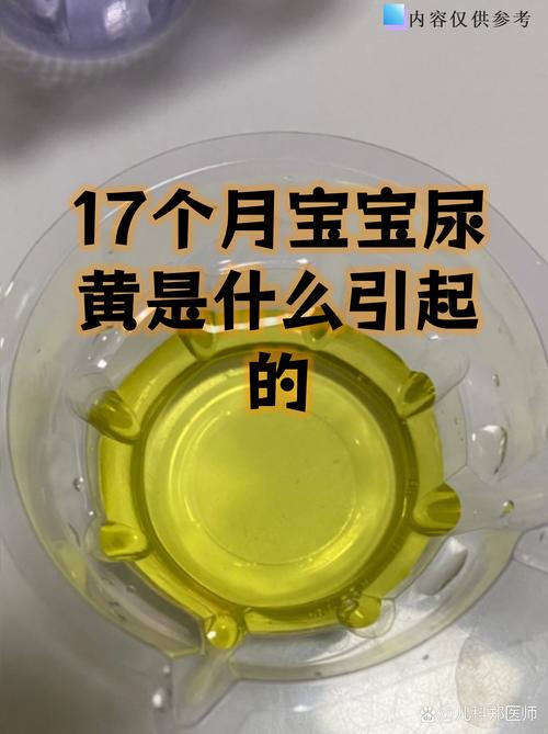 新生儿尿黄是上火还是疾病信号？需警惕哪些潜在健康问题？-第1张图片-郑州医学网