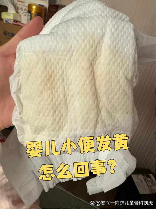 新生儿尿黄是上火还是疾病信号？需警惕哪些潜在健康问题？-第3张图片-郑州医学网