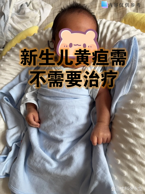 新生儿黄疸到底需不需要吃药？不治疗会有哪些风险？-第3张图片-郑州医学网