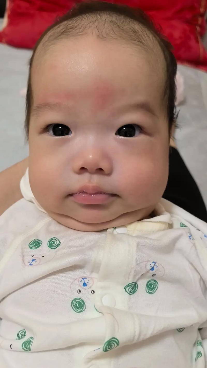 新生儿斯文文的新生儿抖下巴是正常现象还是异常信号？-第3张图片-郑州医学网