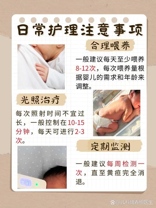 新生儿黄疸偏高究竟是什么原因导致的呢？-第3张图片-郑州医学网