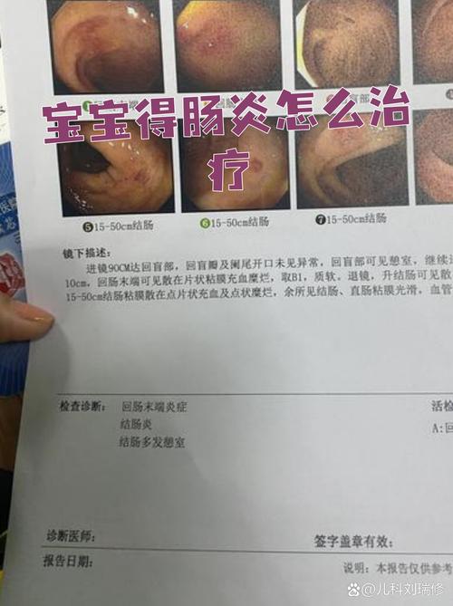 新生儿肠炎有哪些典型症状？如何科学治疗与护理？-第1张图片-郑州医学网