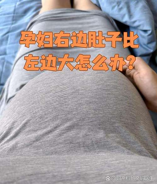 孕期左边肚子比右边大，是胎儿位置异常还是正常生理差异？-第1张图片-郑州医学网