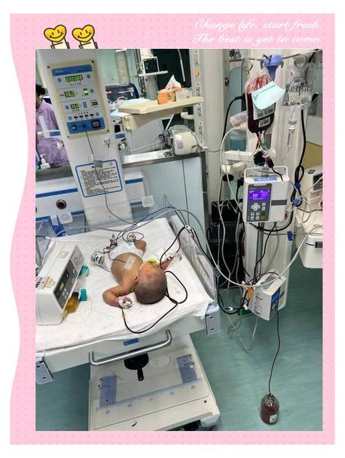 新生儿Rh溶血症换血治疗的关键难点与风险管控措施有哪些？-第1张图片-郑州医学网