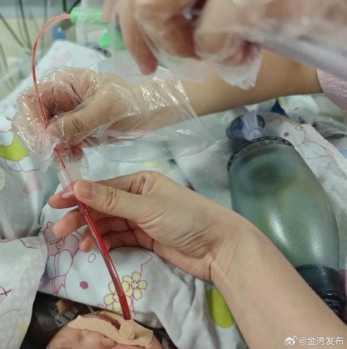 新生儿Rh溶血症换血治疗的关键难点与风险管控措施有哪些？-第2张图片-郑州医学网