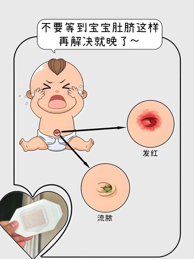 新生儿肚脐到底几天才能安全沾水？过早或过晚会有风险吗？-第2张图片-郑州医学网