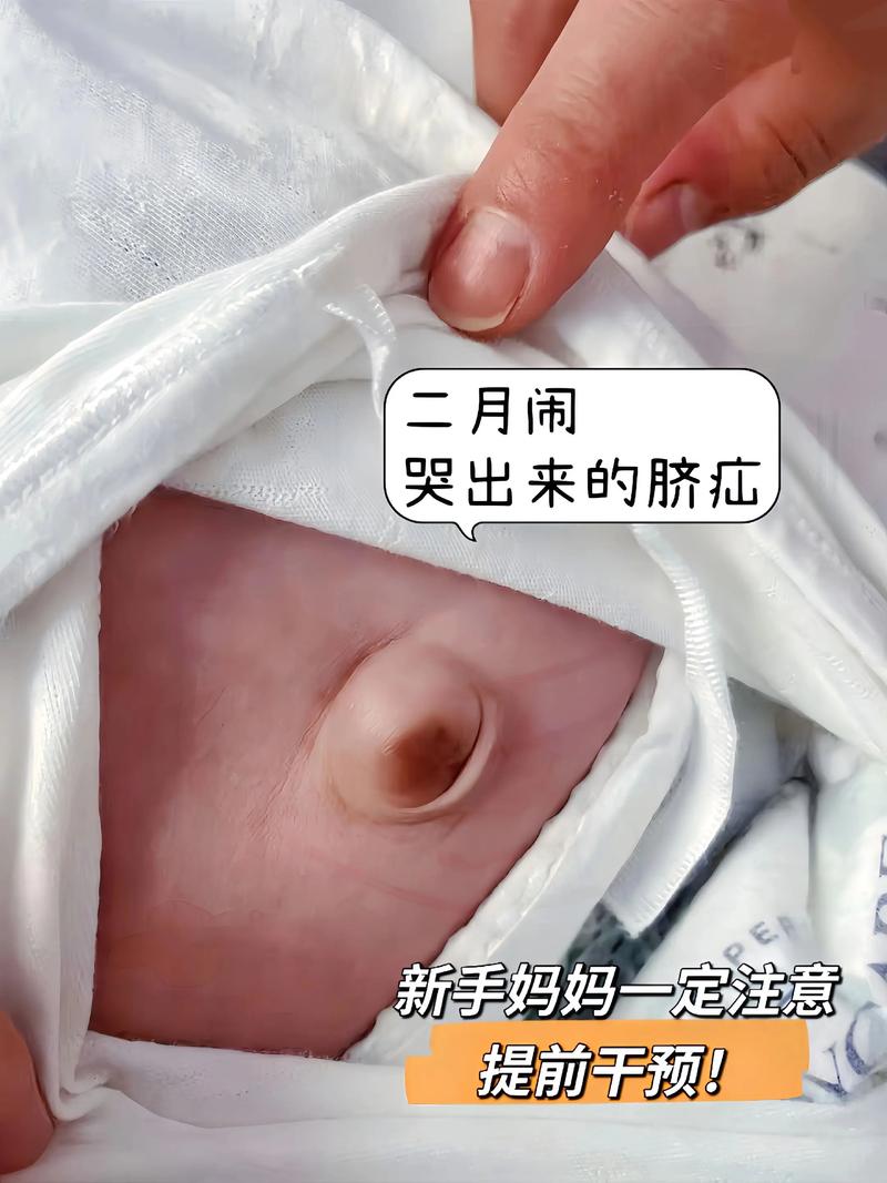 新生儿肚脐到底几天才能安全沾水？过早或过晚会有风险吗？-第3张图片-郑州医学网