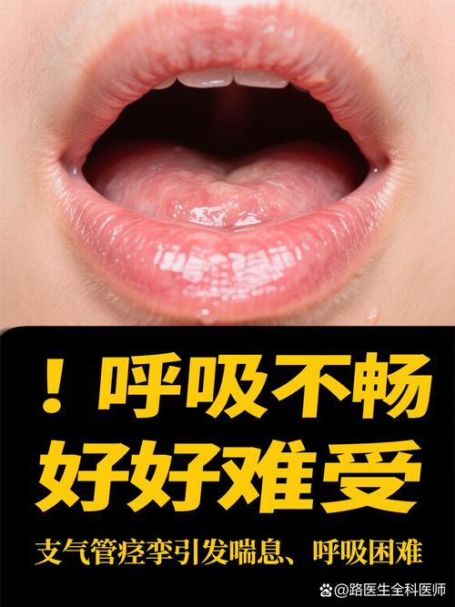 儿童氨茶碱用量怎么算？不同年龄体重剂量差异大吗？-第3张图片-郑州医学网