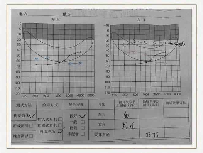 新生儿听力怎样才算正常？不同阶段听力表现差异大，家长如何判断？-第2张图片-郑州医学网