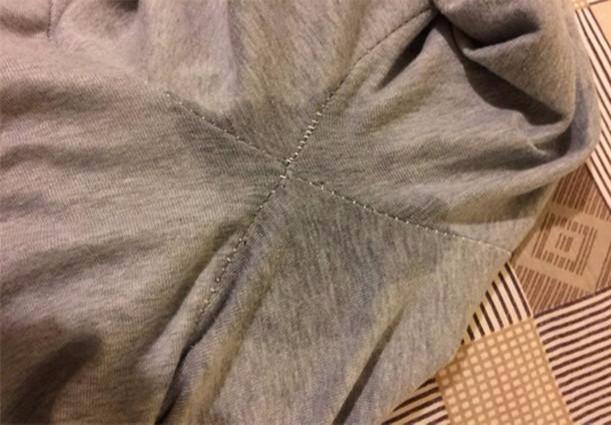 怀孕期间分泌物有异味是正常现象吗？会对胎儿健康造成影响吗？-第1张图片-郑州医学网