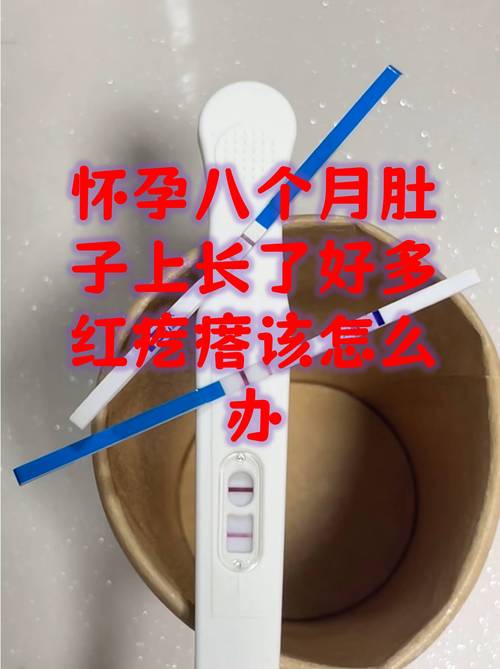 怀孕期间长痘痘怎么办？安全有效的祛痘方法有哪些？-第3张图片-郑州医学网