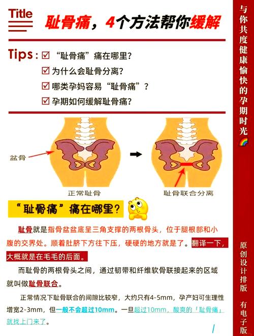 怀孕期间耻骨疼得厉害，到底该怎么缓解才有效？-第2张图片-郑州医学网