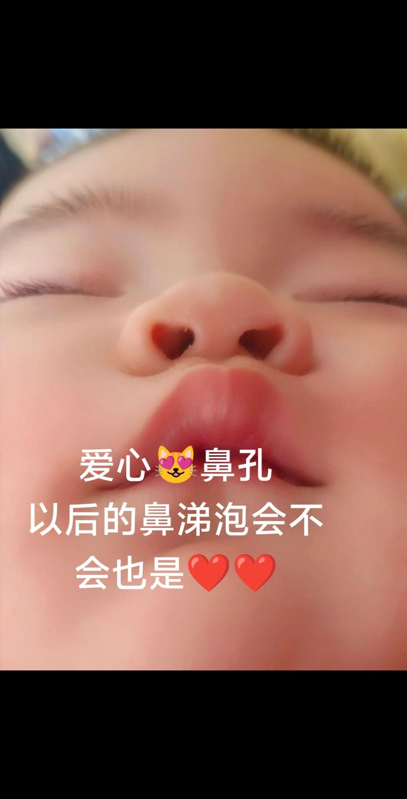 新生儿睡觉有鼻音是正常现象吗？需要担心或处理吗？-第3张图片-郑州医学网