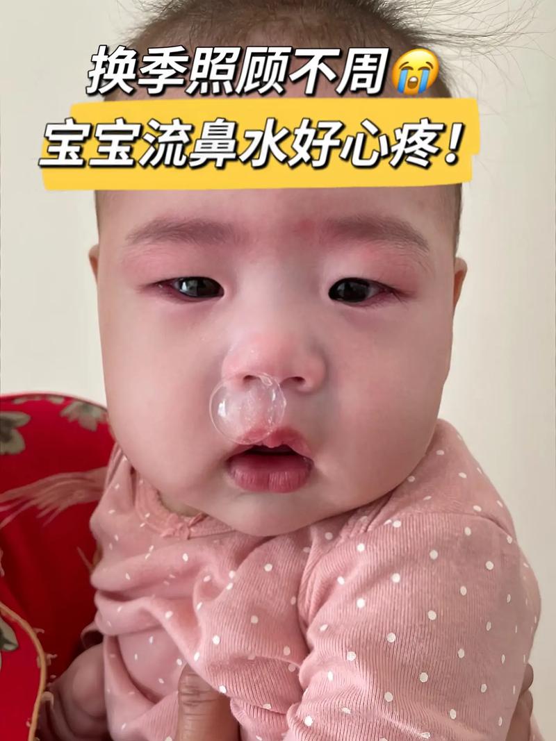 新生儿鼻子有鼻涕但不会擤鼻涕，家长该如何正确处理和护理？-第3张图片-郑州医学网