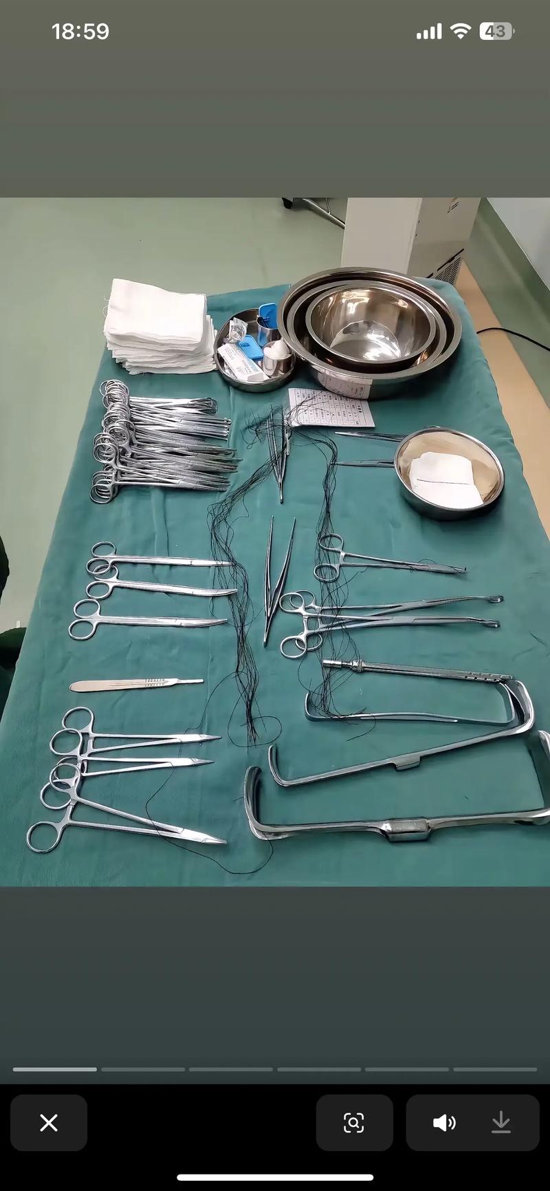 怀孕期间做手术打麻药-第2张图片-郑州医学网