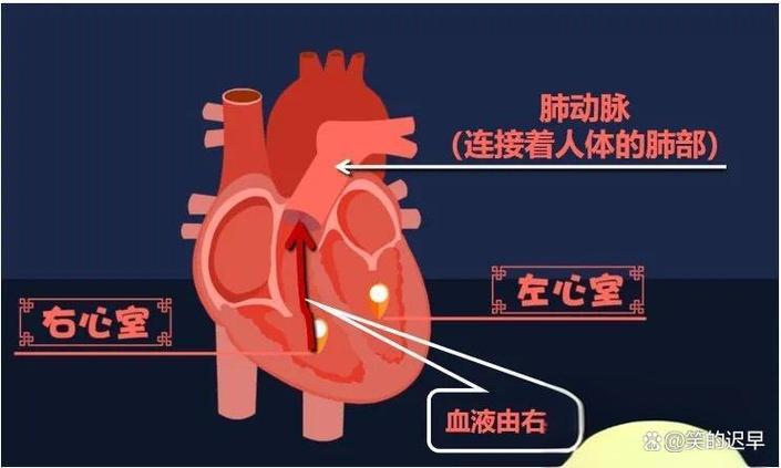 新生儿肺动脉重度狭窄有哪些症状及治疗方法？-第3张图片-郑州医学网