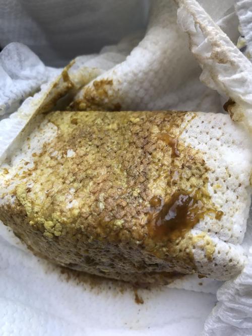 新生儿大便呈果冻状正常吗?附图片详解不同情况下的应对方法-第3张图片-郑州医学网 新生儿大便呈果冻状正常吗?附图片详解不同情况下的应对方法-第3张图片-郑州医学网