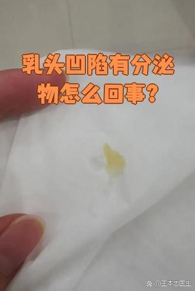 怀孕期间乳头出现脏东西是正常现象吗？需要特殊处理吗？-第1张图片-郑州医学网