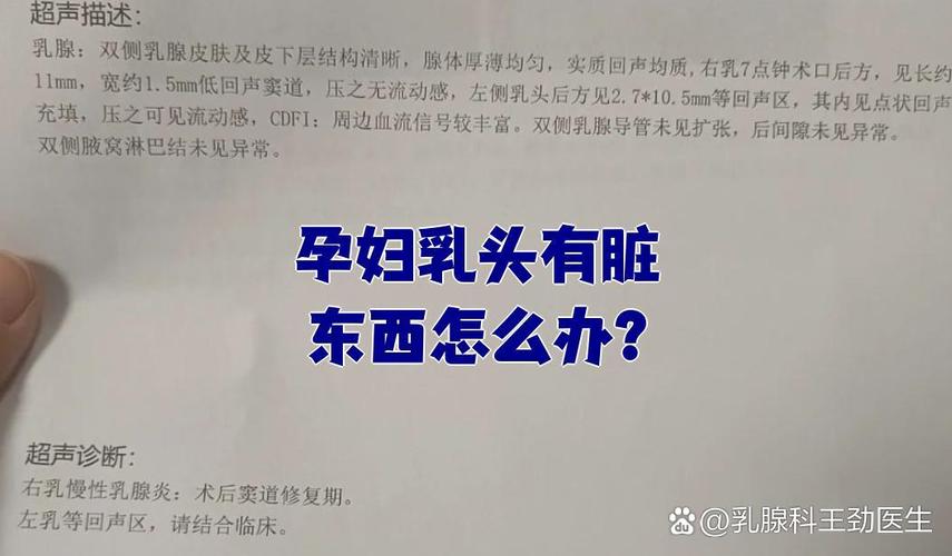 怀孕期间乳头出现脏东西是正常现象吗？需要特殊处理吗？-第3张图片-郑州医学网