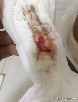 备孕期月经量突然变少，是怀孕信号还是身体出问题了？-第2张图片-郑州医学网