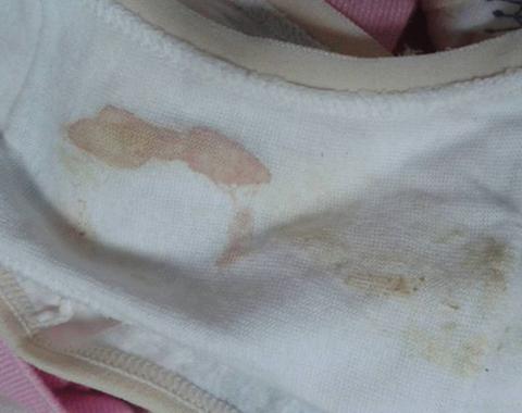 备孕期月经量突然变少，是怀孕信号还是身体出问题了？-第1张图片-郑州医学网