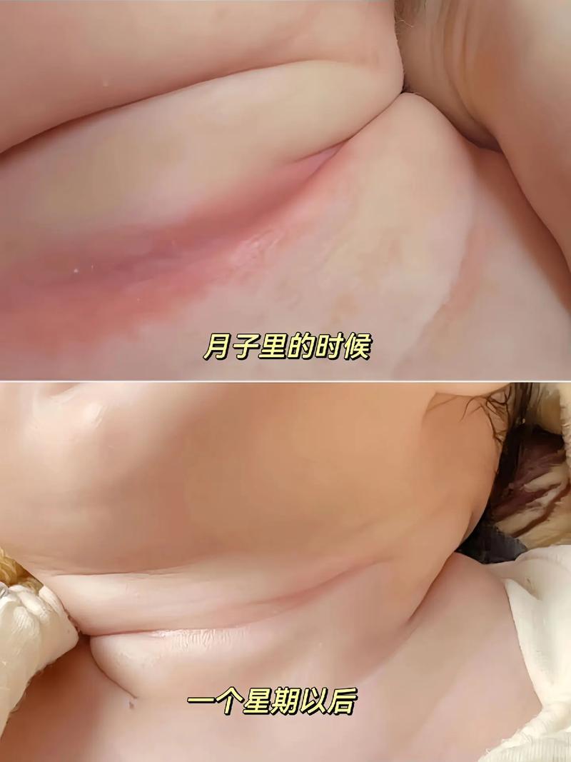 新生儿下面白色粘稠物是什么？需要清理吗？会影响健康吗？-第2张图片-郑州医学网