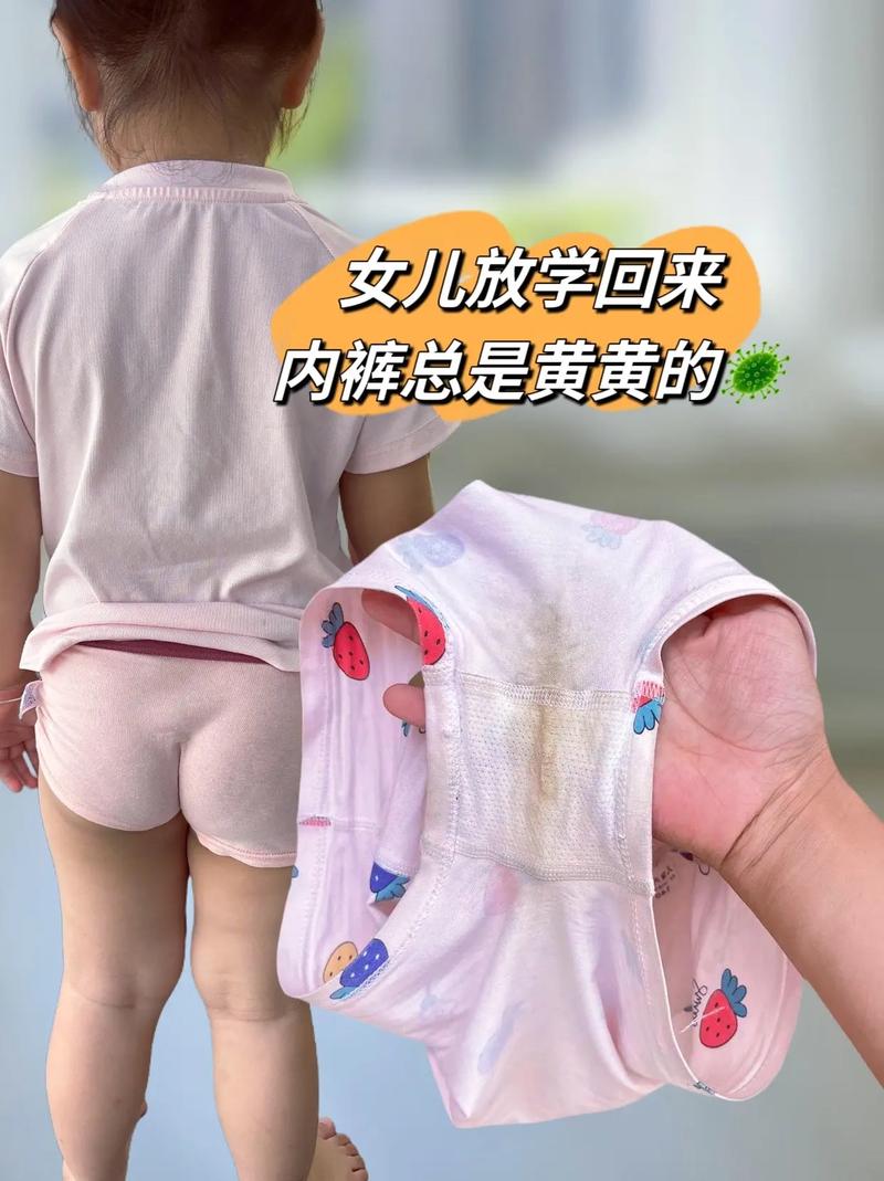 新生儿下面白色粘稠物是什么？需要清理吗？会影响健康吗？-第3张图片-郑州医学网