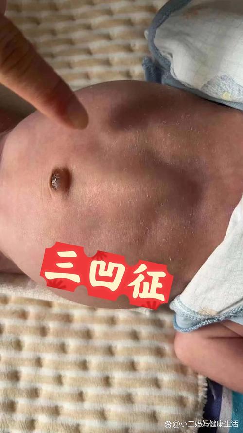 新生儿缺氧的早期症状有哪些容易被家长忽视的危险信号？-第1张图片-郑州医学网